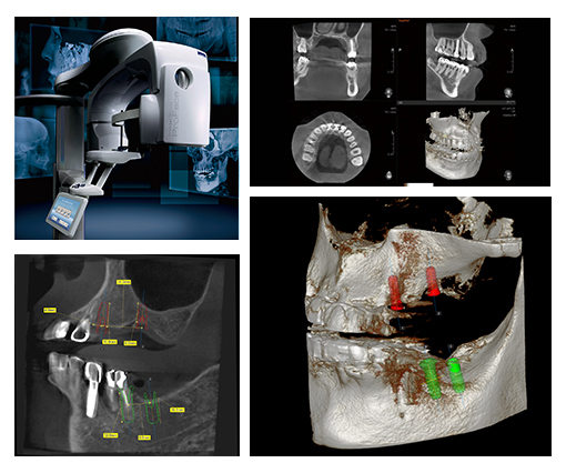 歯科用CT(PLANMECA ProMax 3D)の診断が可能になりました