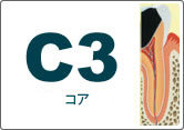 c3 RA